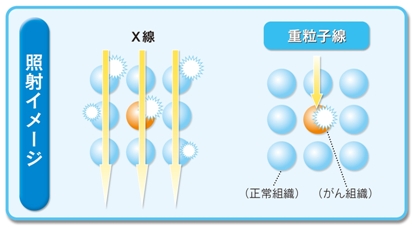 重粒子線がん治療についての画像2