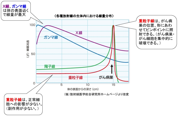 重粒子線がん治療の特徴の画像