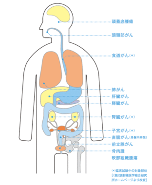 重粒子線がん治療の対象となるがんの画像